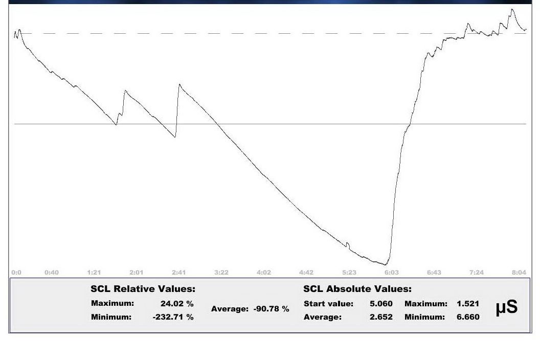 Curva di attivazione registrata durante una sessione di biofeedback